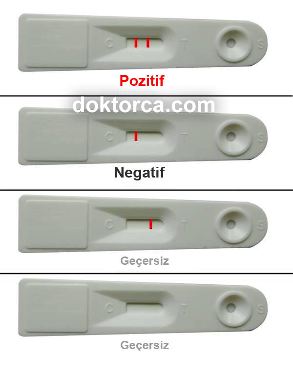 gaitada gizli kan testi GGK anlamı ve yorumu. Tek ve çift çizgi ne demek?