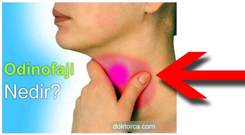Odinofaji - Özellikle fotoğrafta görülen kırmızı bölgede ağrılar hissedilir