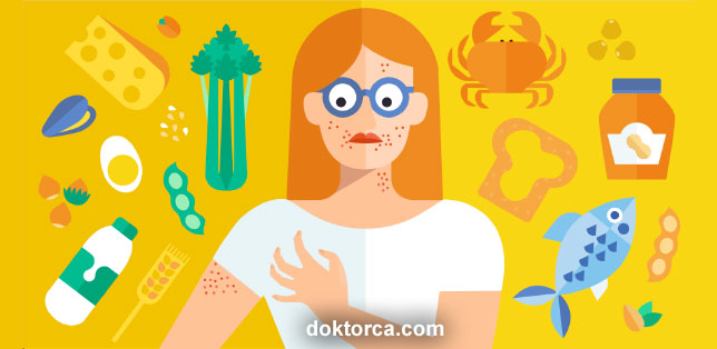 gıda alerjisi testi