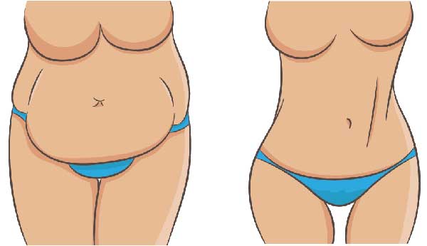 Karın Germe detayları