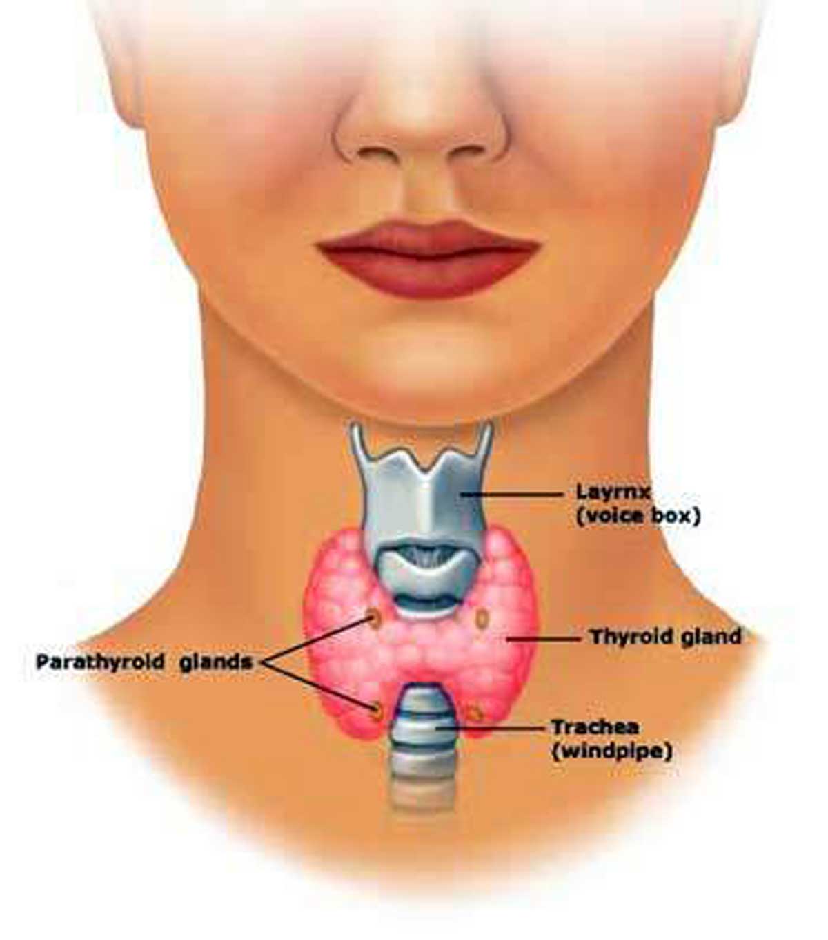 Her boyun şişliği Guatr mı?
