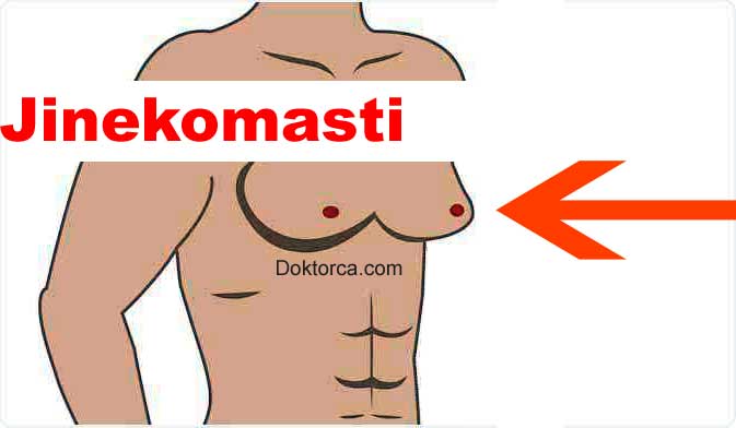 Jinekomasti tehlikeli mi?