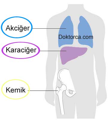 Kolorektal kanserin en fazla metastaz yaptığı bölgeler