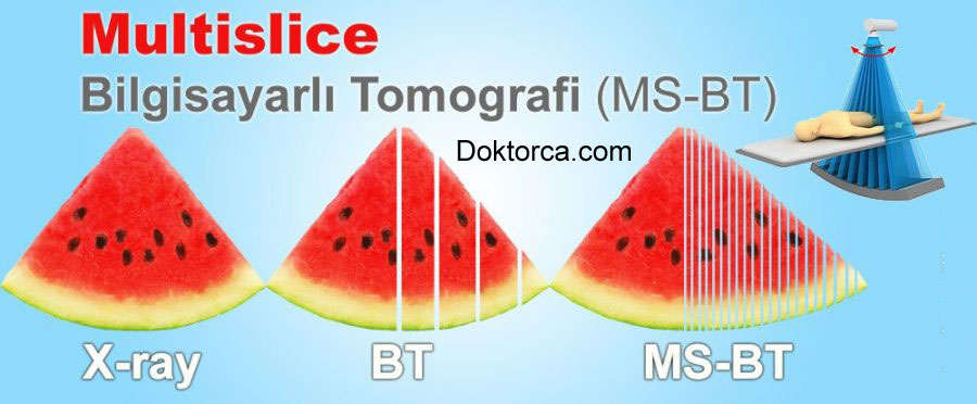 Multislice Tomografi