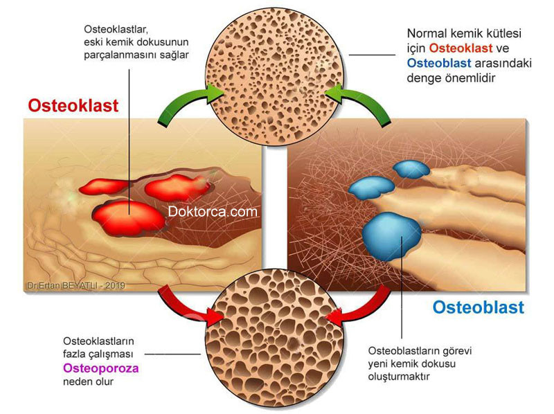 Osteoklast, osteoblast ve osteoporoz arasındaki ilişki Kemik Erimesi
