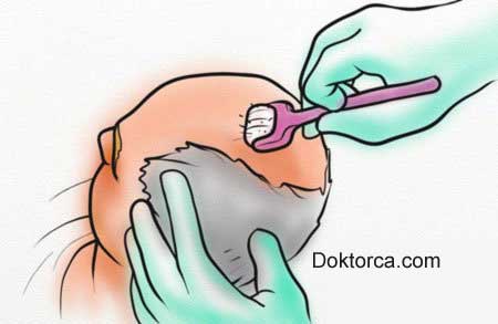 Saç için mezoterapi