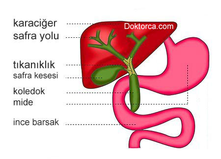 Postkolesistektomi Sendromu nedir?